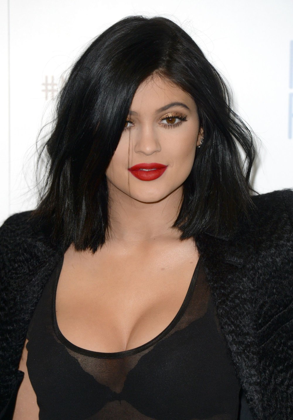 380934-kylie-jenner-atelle-subi-une-orig-1.jpg